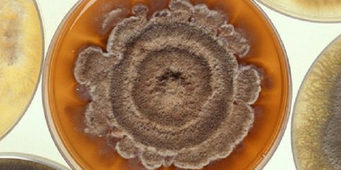 Beware of Hotel Room Germs