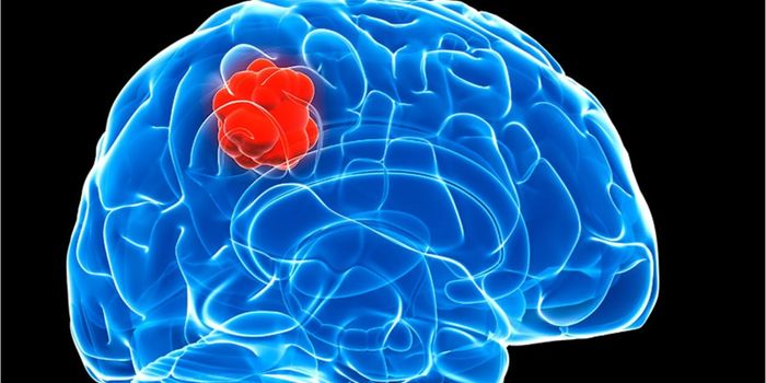 A Novel Glioblastoma Therapy
