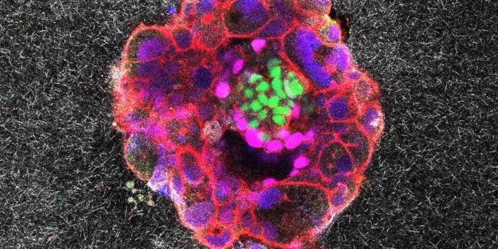 The First Real Time View of Human Embryo Implantation