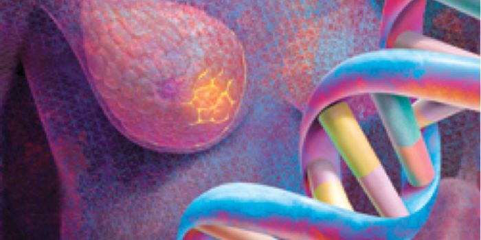 More Young Women with Breast Cancer Seek Genetic Testing