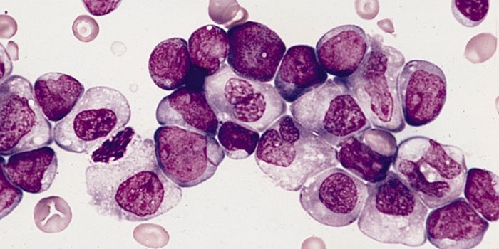 First Hydrocarbon Peptide Therapeutic for Lethal Leukemia