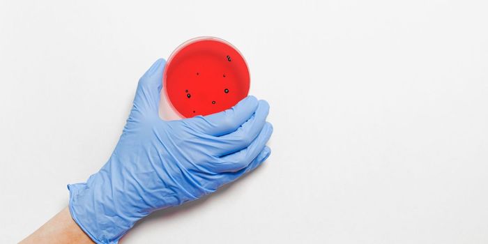 New Antibiotic Shows Promise Against Treatment-Resistant Tuberculosis