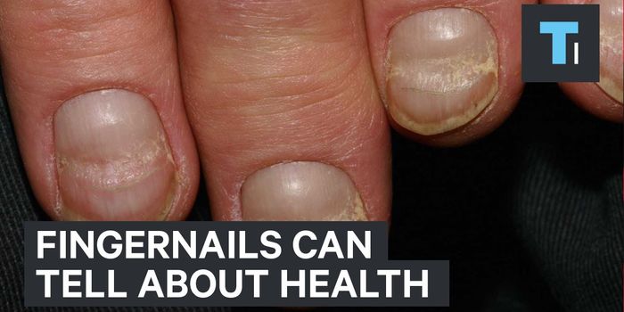 What are those lines on my fingertips?