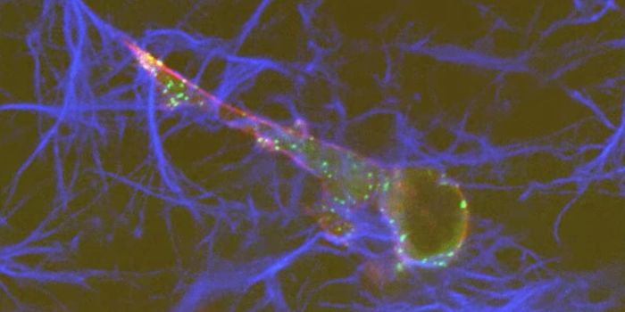 New Mechanism of Cancer Cell Migration Discovered