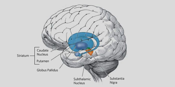 Drug for Huntington Disease Successfully Lowers Culprit Protein
