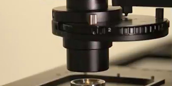 Super-resolution Microscope Provides Insight Into Alzheimer's Plaques