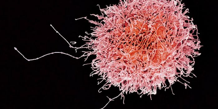 Immunotherapy Diversification: From CAR-T cells to CAR-NK cells