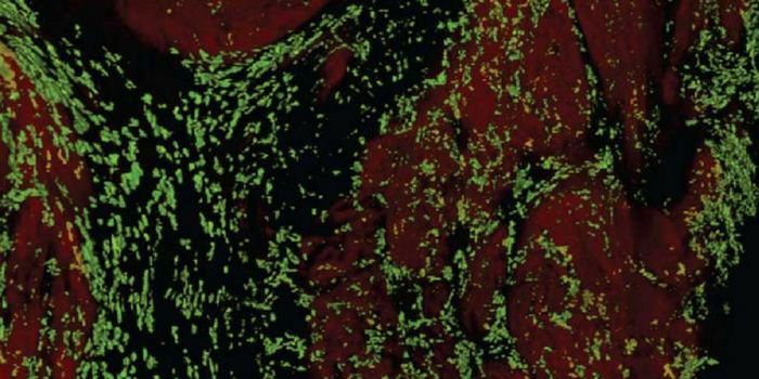 Why We Want Macrophages in the Heart