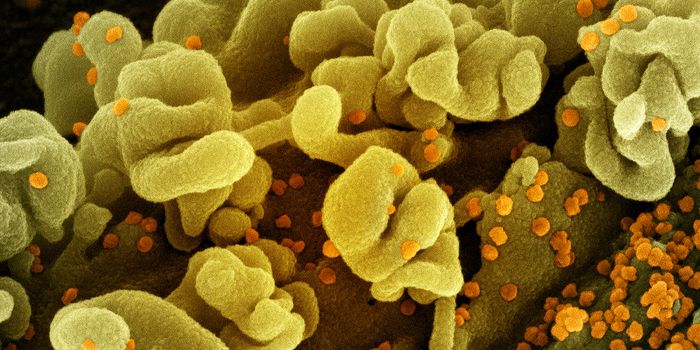 How COVID-19 Can Disrupt the Brain