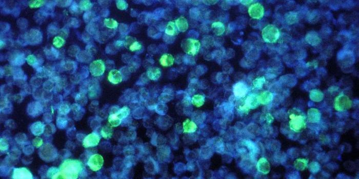 How a Gene Variant Raises the Risk of Multiple Sclerosis