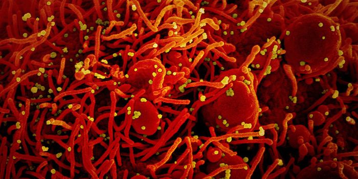 Nose Cells Found to Be Likely SARS-CoV-2 Entry Points