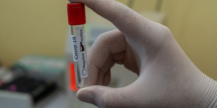 Novel COVID-19 Test Based on Quantum Physics