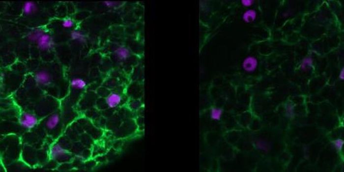 New Insights Into Epilepsy