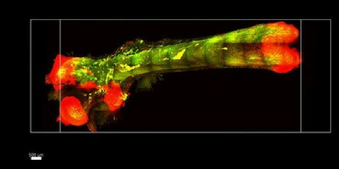 This Technique Makes Bones Transparent