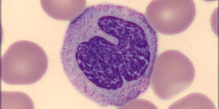 Standardizing the Hematology Stain Workflow with Aerospray® and CellaVision®