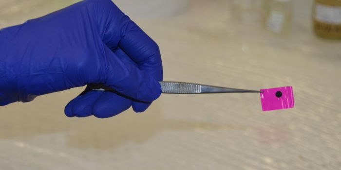 Heart Patch to the Rescue for Heart Attack Survivors