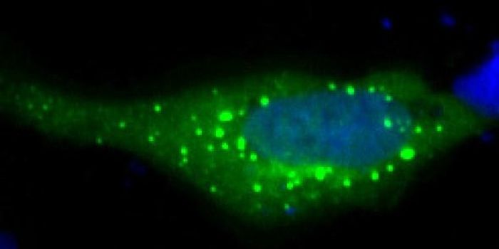 Cytoplasmic Droplet Formation is Related to Protein Regulation