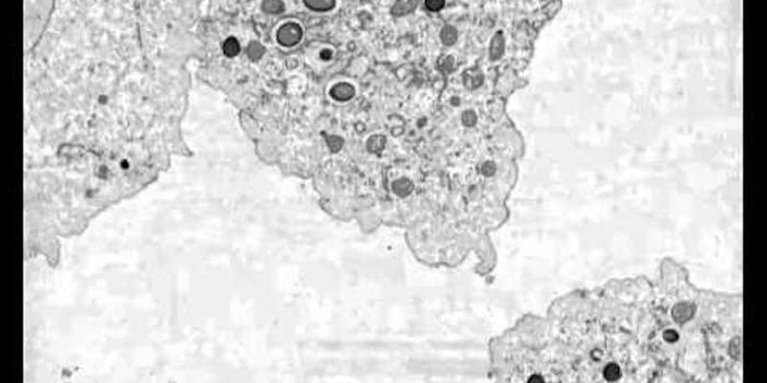 Researchers Surprised to Find Giant Viruses in Forest Soil