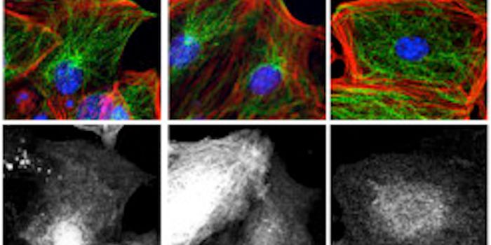 Protein Helps Cells Retain Structure in Spite of Squeezing