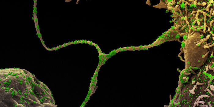 How COVID-19 Patients Lose Their Sense of Smell