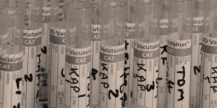 New water quality test glows green upon detecting toxic levels of contamination