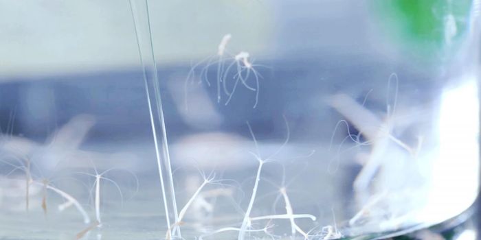 Too Much Food may Disrupt the Microbiome and Lead to Illness