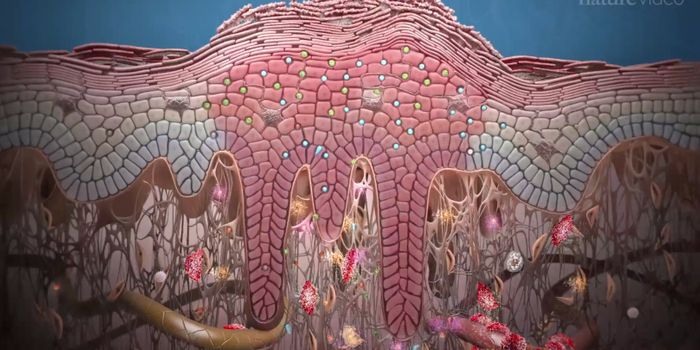 Cytokine IL-17 Could Be New Drug Target for Psoriasis