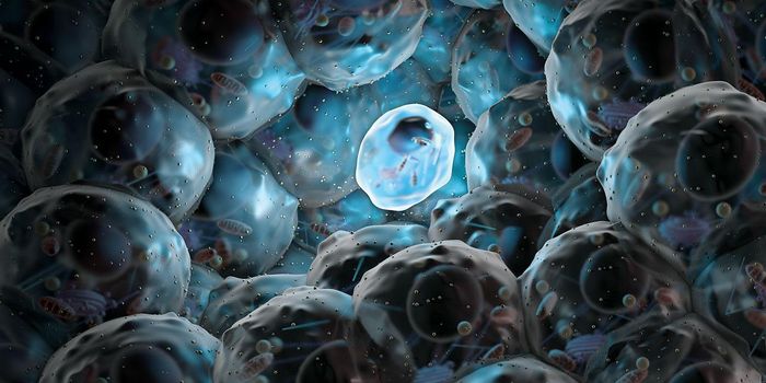 Stem Cells to the Rescue! Treating Scleroderma