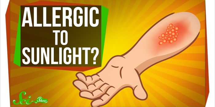 It's Not Vampirism, It's a Sun Allergy
