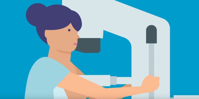 Surgeons Call for Mammograms for Younger Women, "Prioritize Life"