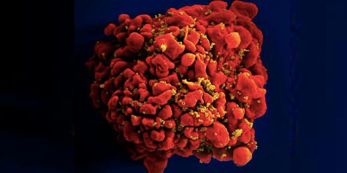 The Immune System Can Kill HIV with a Helper Molecule