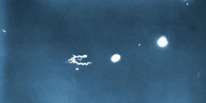 Syphilis is on the Rise, and Infants are Paying a High Price