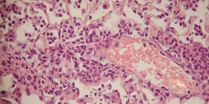 Liver Hormone Hides from Pneumonia Bacteria