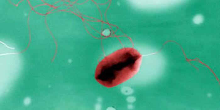 Advances in the Detection of Bacterial Contamination in Food