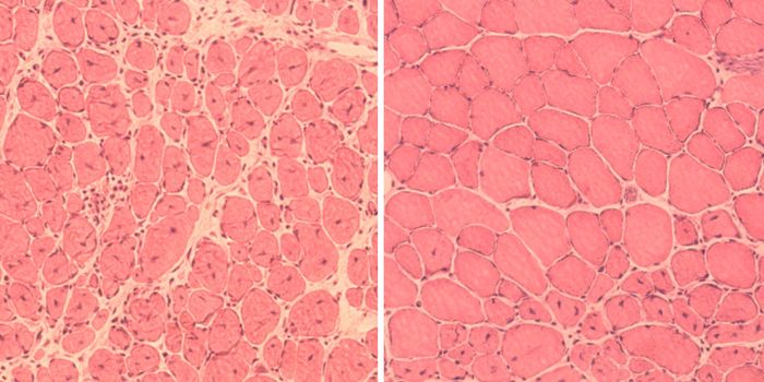 Aging May be Reversible in Mice