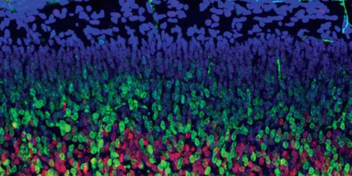 Newborns could be treated for autism or schizophrenia with gene-splice discovery