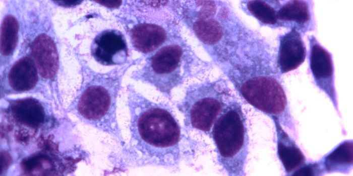 Henrietta Lacks: A Donor who Keeps on Giving