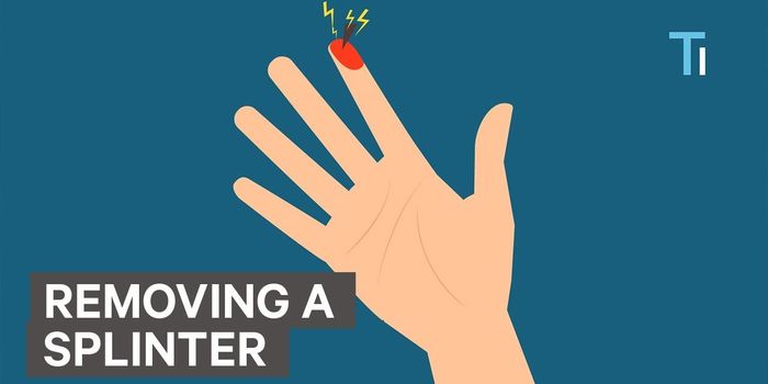 What's the Best Way to Treat a Splinter?