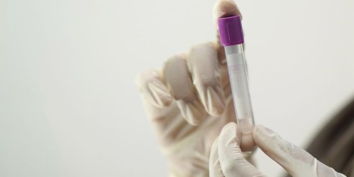 A Breakthrough New Test Can Diagnose Chronic Fatigue Syndrome