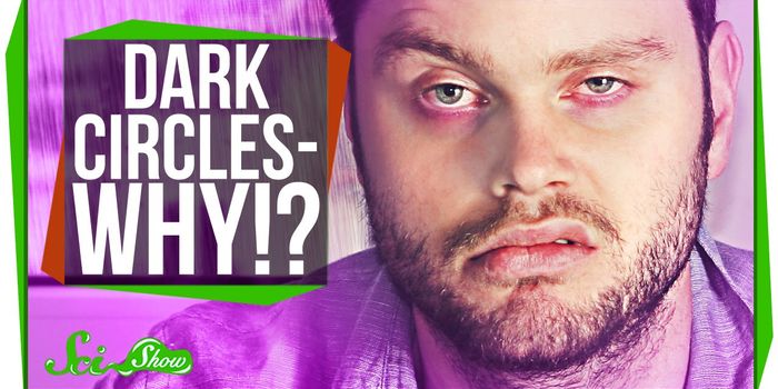 Why Cold Remedies Work to Get Rid of Dark Circles