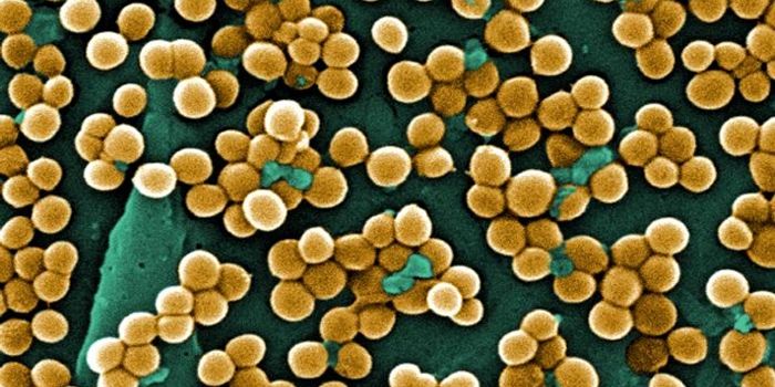 MRSA Can Linger In Homes, Spreading Among Its Inhabitants