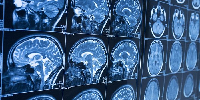 PDE4B Inhibitor to Treat Traumatic Brain Injury