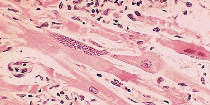 Extracellular Vesicles Help Heart Cells Survive a Heart Attack