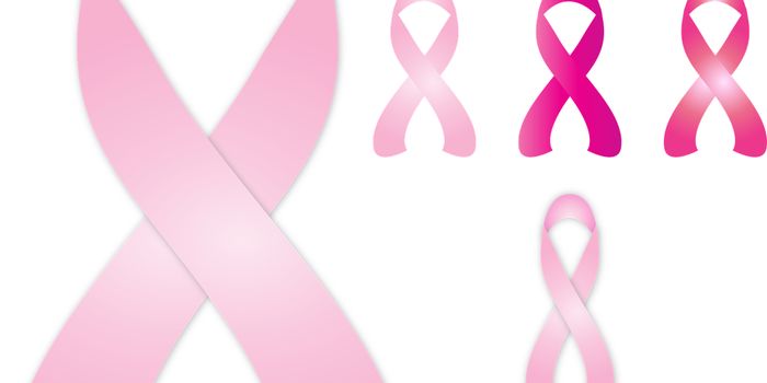 AI Can Help Predict Breast Cancer Diagnoses before Mammography