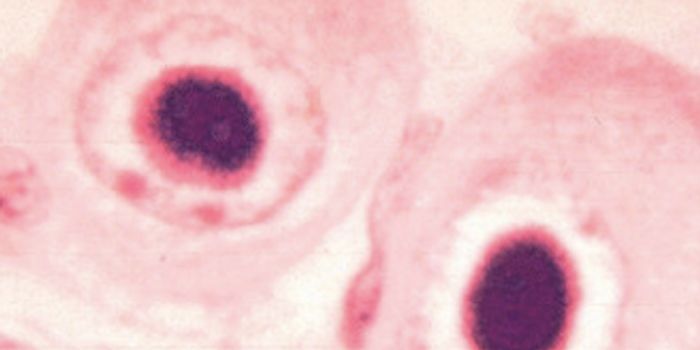 Finding a New Way to Combat Viruses