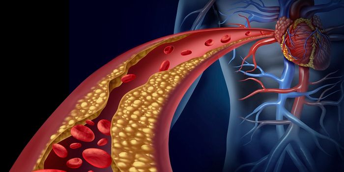 Catching Harmful Atherosclerosis Plaques ASAP