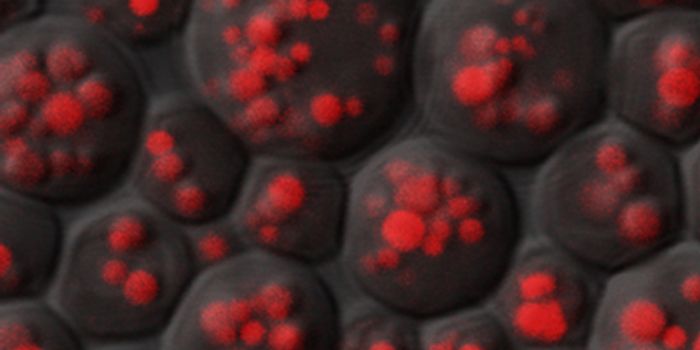 Fat Droplets Prevent Cellular Damage Related to Stress