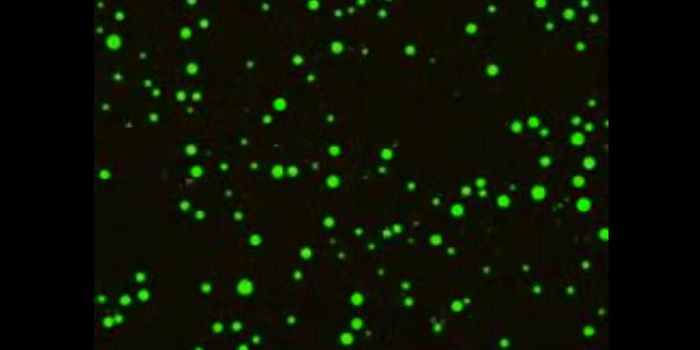Investigating the Formation of Membrane-less Organelles