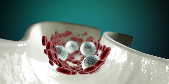 Immune Cells Found to Drive Complex Symptoms of Systemic Sclerosis
