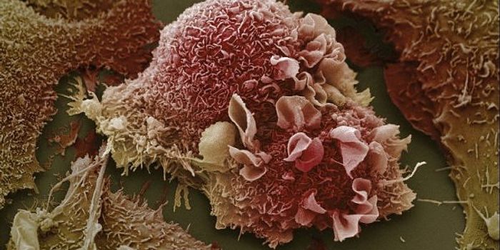 FDA Grants Breakthrough Therapy Designation for Genentech Investigational Cancer Immunotherapy for Non-Small Cell Lung Cancer